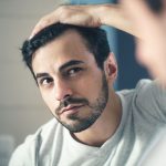 A Step By Step Guide To Hair Transplant
