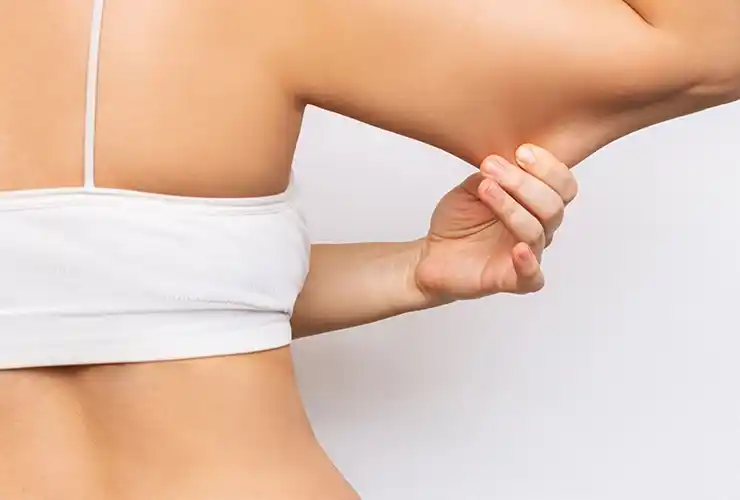 Arm Lift