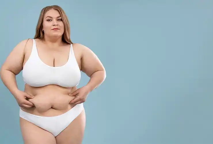 obesity surgery
