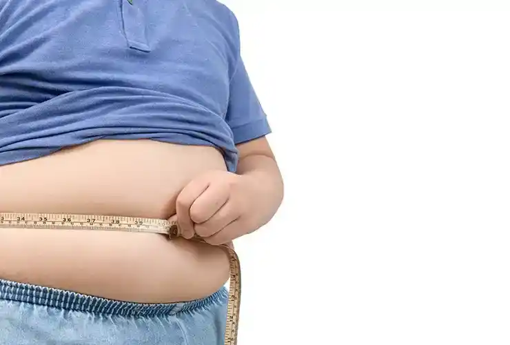 sleeve-gastrectomy