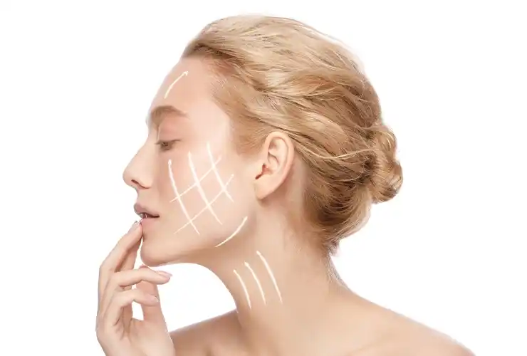 Face Lift