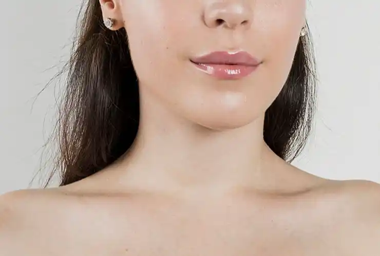 Facial Implant