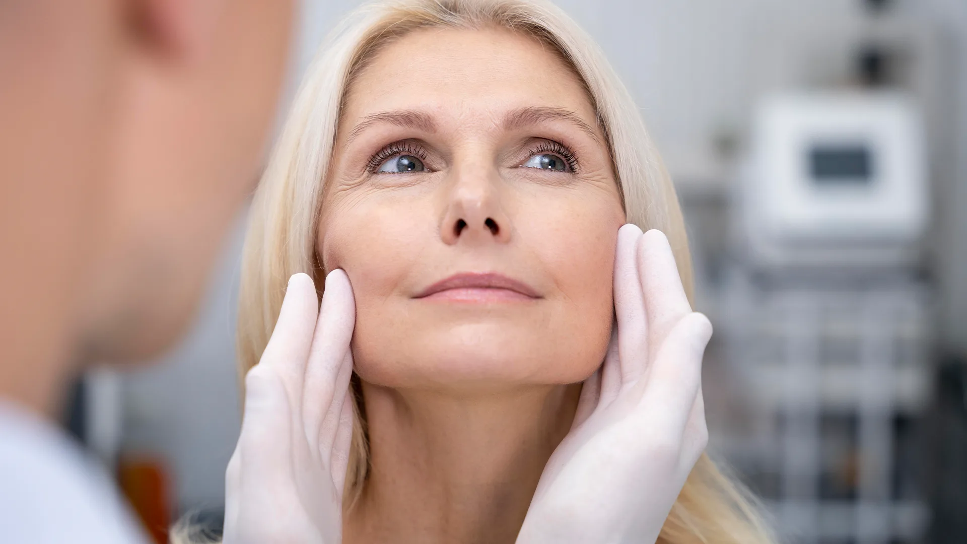 face-lift